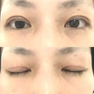 聖心美容クリニック 福岡院口コミ