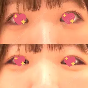 銀座みゆき通り美容外科 大阪梅田院口コミ