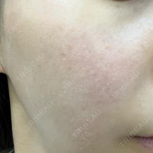 赤羽ひだまりクリニック皮膚科・美容外科口コミ