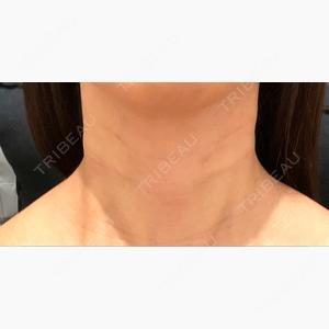 PRO CLINIC プロクリニック 銀座院口コミ