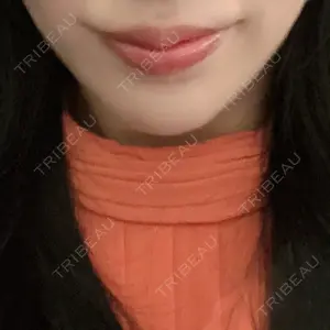 メディカルアルファクリニック口コミ