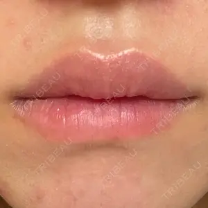Lūna Beauty Clinic口コミ