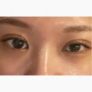 ルラ美容クリニック 渋谷本院口コミ