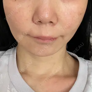 THE LINE CLINIC KICHIJOJI口コミ