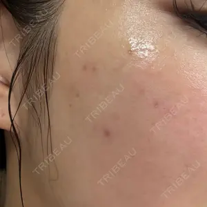 BRIGHTS beauty clinic口コミ