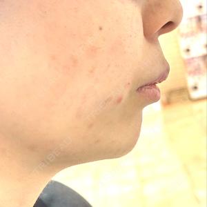 TCB東京中央美容外科 岡山院口コミ