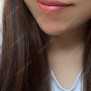 ルラ美容クリニック 岐阜院口コミ