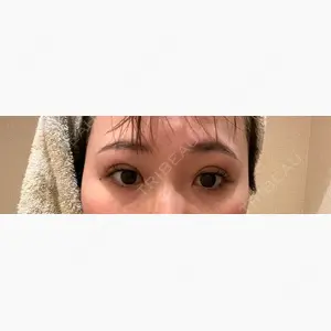 東京シンデレラ美容外科 大宮院口コミ