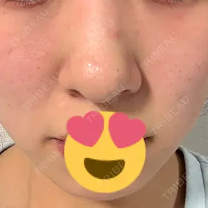ZX-CLINIC 梅田院口コミ