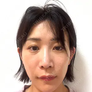 インクリニック口コミ