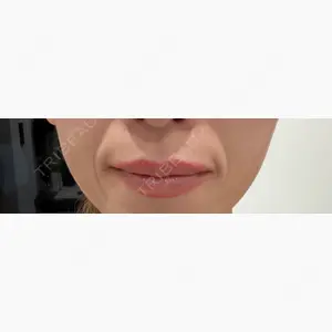 オザキクリニック LUXE新宿口コミ