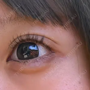 ルラ美容クリニック 熊本院口コミ
