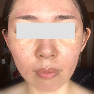 CHARIS BEAUTY CLINIC口コミ