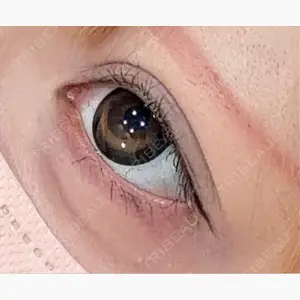 アリエル美容クリニック 大宮院口コミ