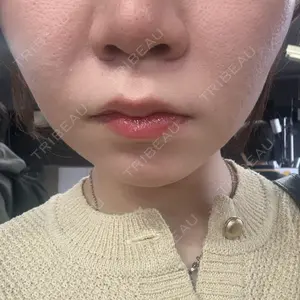 名古屋駅前ゆう美容クリニック口コミ