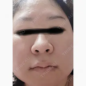 小倉美容外科/美容皮膚科 ビラビューティークリニック口コミ