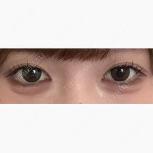 吉祥寺アイビークリニック口コミ