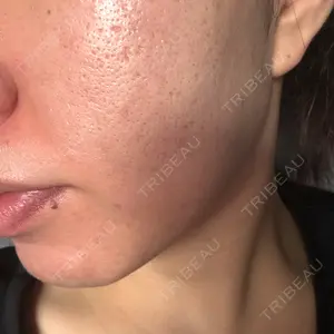 愛知春日井美容外科ネビュラクリニック口コミ