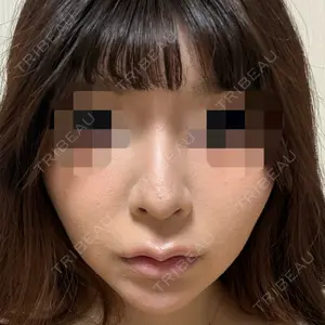 PRO CLINIC プロクリニック 銀座院口コミ