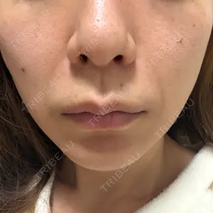 神戸美容外科 ネビュラクリニック口コミ