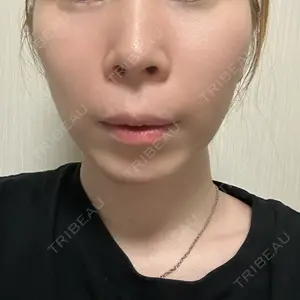 ルラ美容クリニック 広島院口コミ
