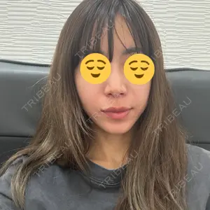 TCB東京中央美容外科 中野院口コミ
