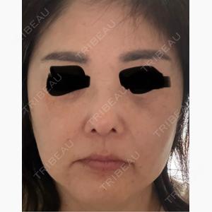 共立美容外科 横浜院口コミ