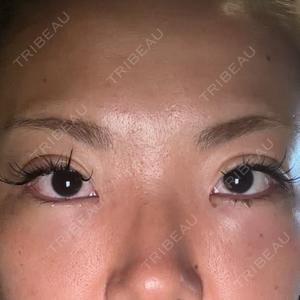 TCB東京中央美容外科 藤沢院口コミ