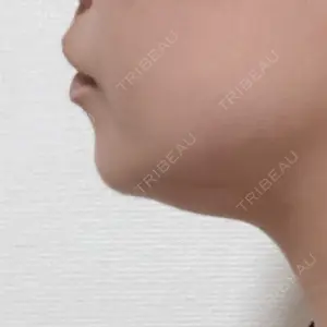 ROHE CLINIC GINZA口コミ