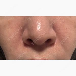 NARU Beauty Clinic 【ナルクリ】 水戸院口コミ