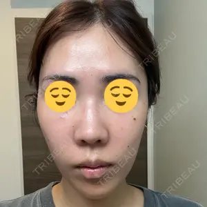 BiBiクリニック口コミ