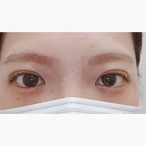 アリエル美容クリニック 水戸院口コミ