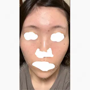 アメリクリニック福岡口コミ