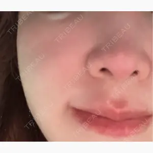 ルラ美容クリニック 京都院口コミ