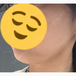 HAAB CLINIC 福岡院口コミ