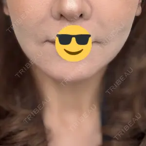 名古屋美容外科口コミ