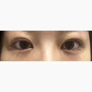 R Beauty CLINIC 名古屋院口コミ