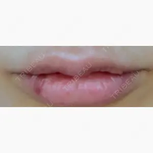 PRO CLINIC プロクリニック 銀座院口コミ