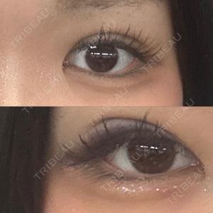 湘南美容クリニック 千葉センシティ院口コミ
