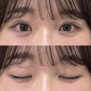 湘南美容クリニック 池袋東口院口コミ