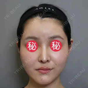 アリエル美容クリニック 大宮院口コミ