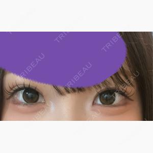 オアシス美容外科口コミ