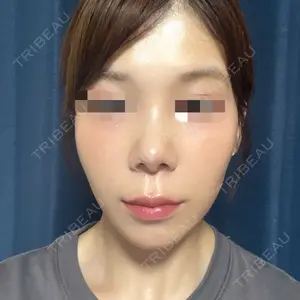 YBC横浜美容外科 池袋院口コミ