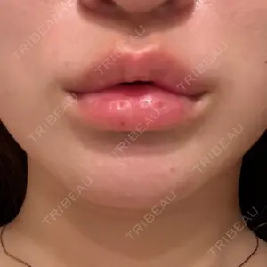 PRO CLINIC プロクリニック 銀座院口コミ