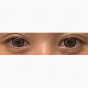 東京シンデレラ美容外科 大宮院口コミ