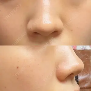 ゆきスキンクリニック 東池袋口コミ