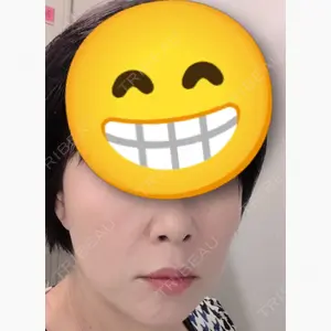 HAAB CLINIC 池袋院口コミ