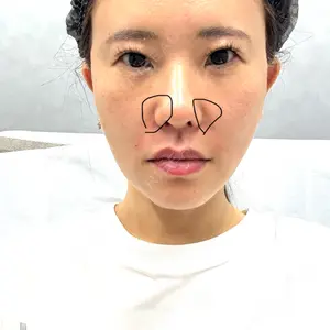 CROWN BEAUTY CLINIC口コミ