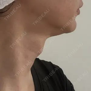 名古屋美容外科口コミ
