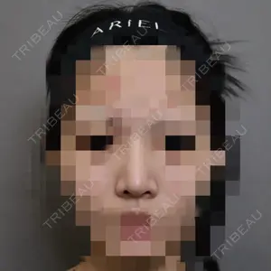 アリエル美容クリニック 大宮院口コミ